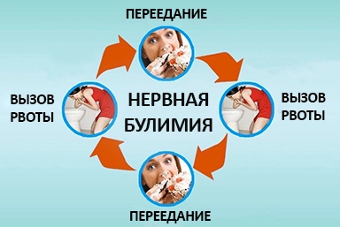 Лечение булимии в Ленске